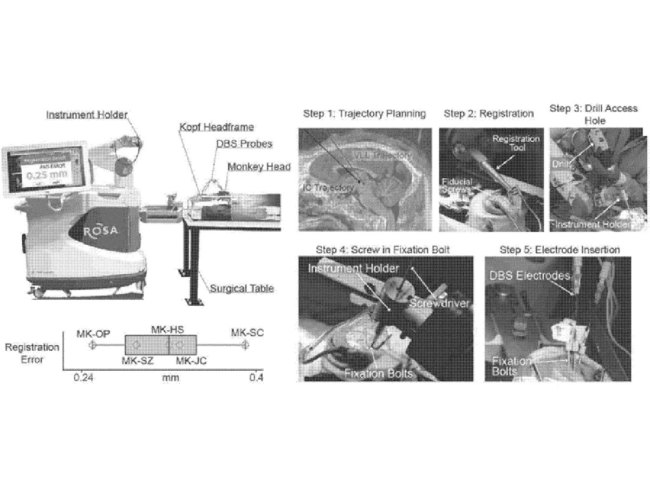 Pitt neurostimilator